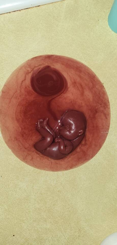 18 week gestation silicone baby in womb with placenta