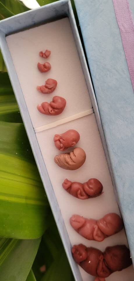 Silicone baby fetus LOT pro life developmental