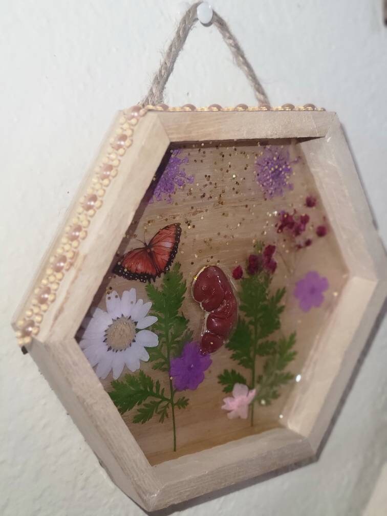 Ready to ship 10 week gestation silicone fetus in Beautiful wood frame with resin back ground