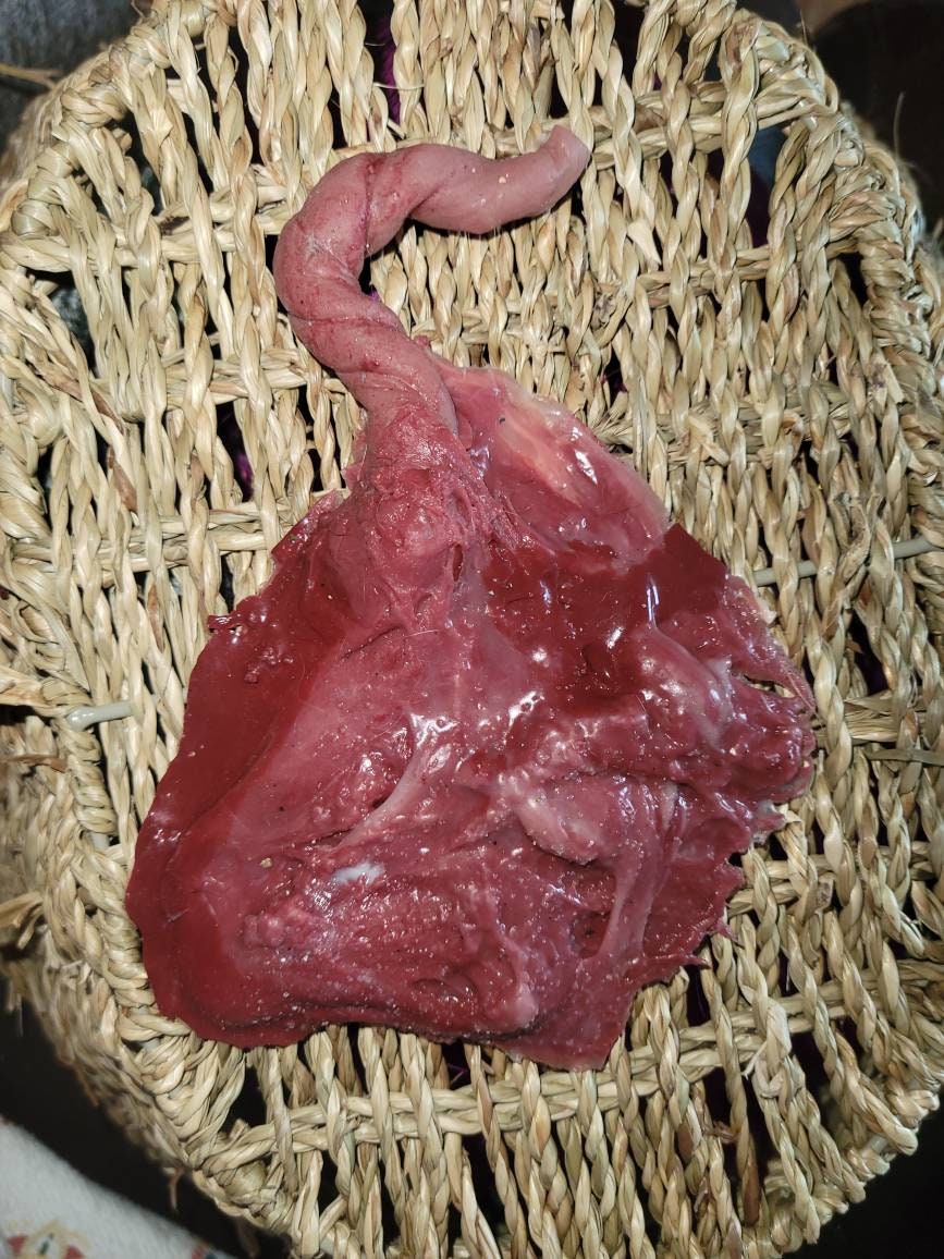 Silicone placenta and umbilical cord for silicone baby