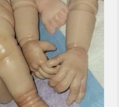 Silicone baby limbs partial limbs with, feet and open hands