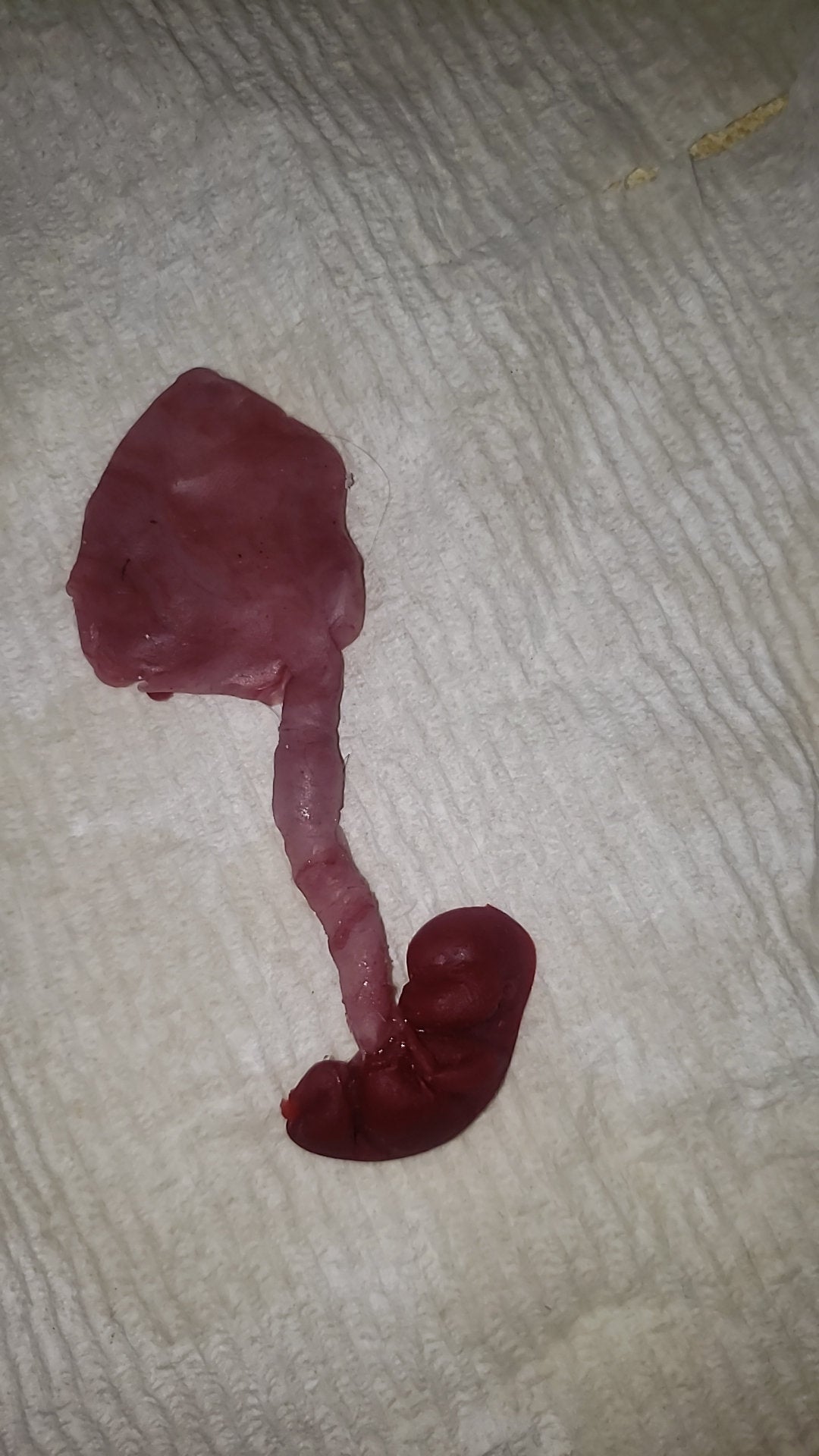 fetus silicone baby memorial with umbilical cord attached