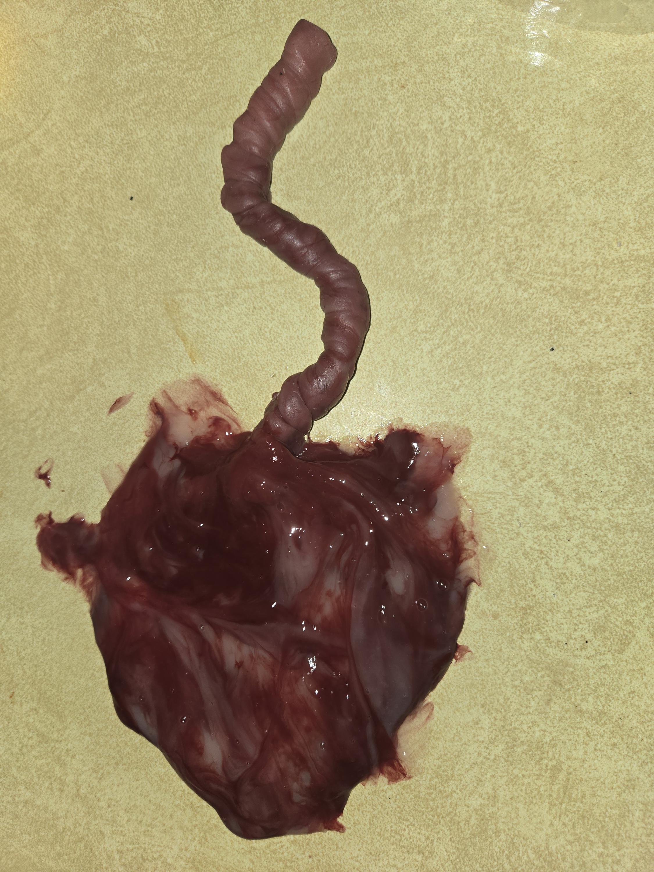warning graphic** Silicone placenta and umbilical cord for silicone baby