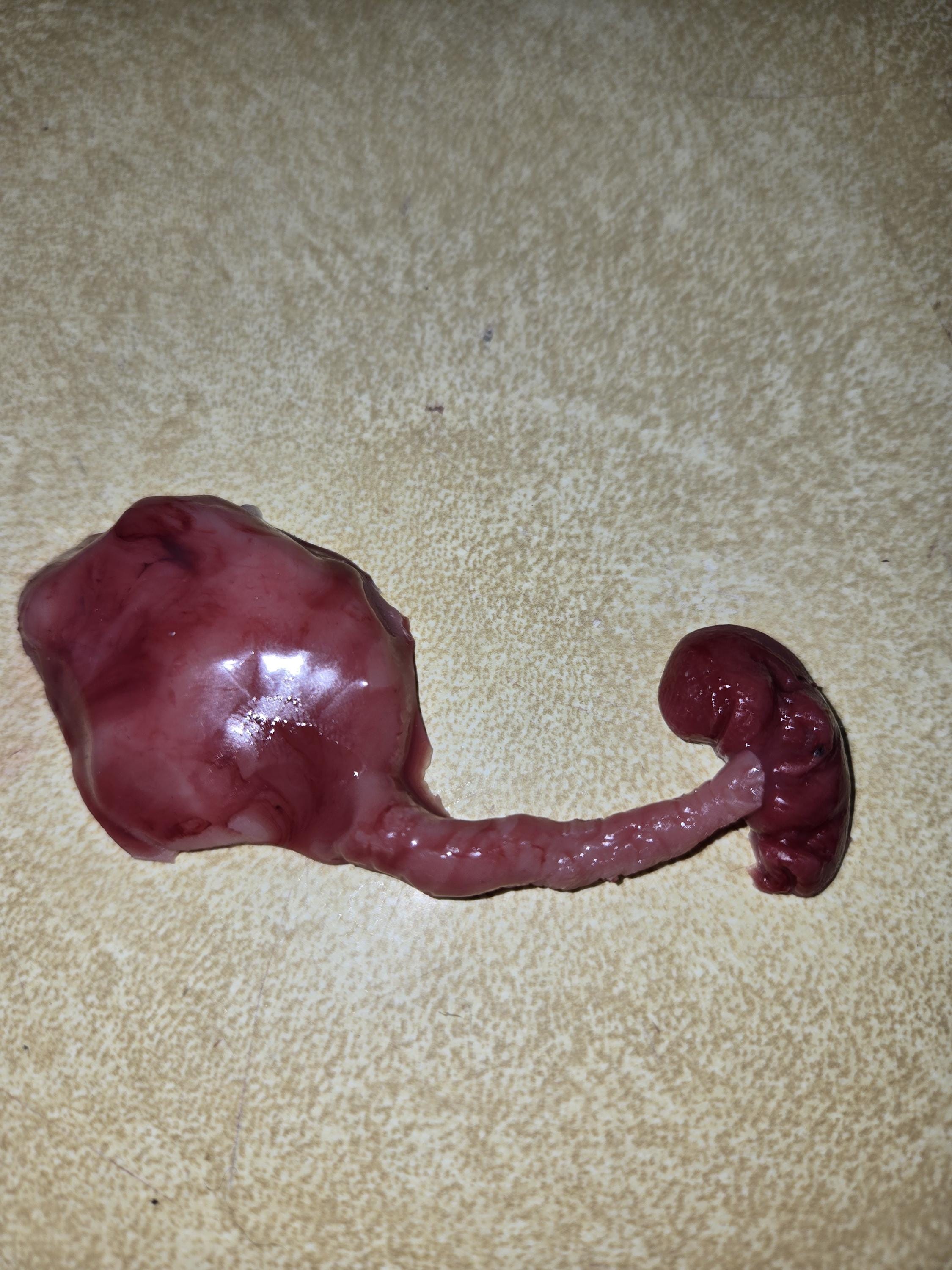 fetus silicone baby memorial with umbilical cord attached