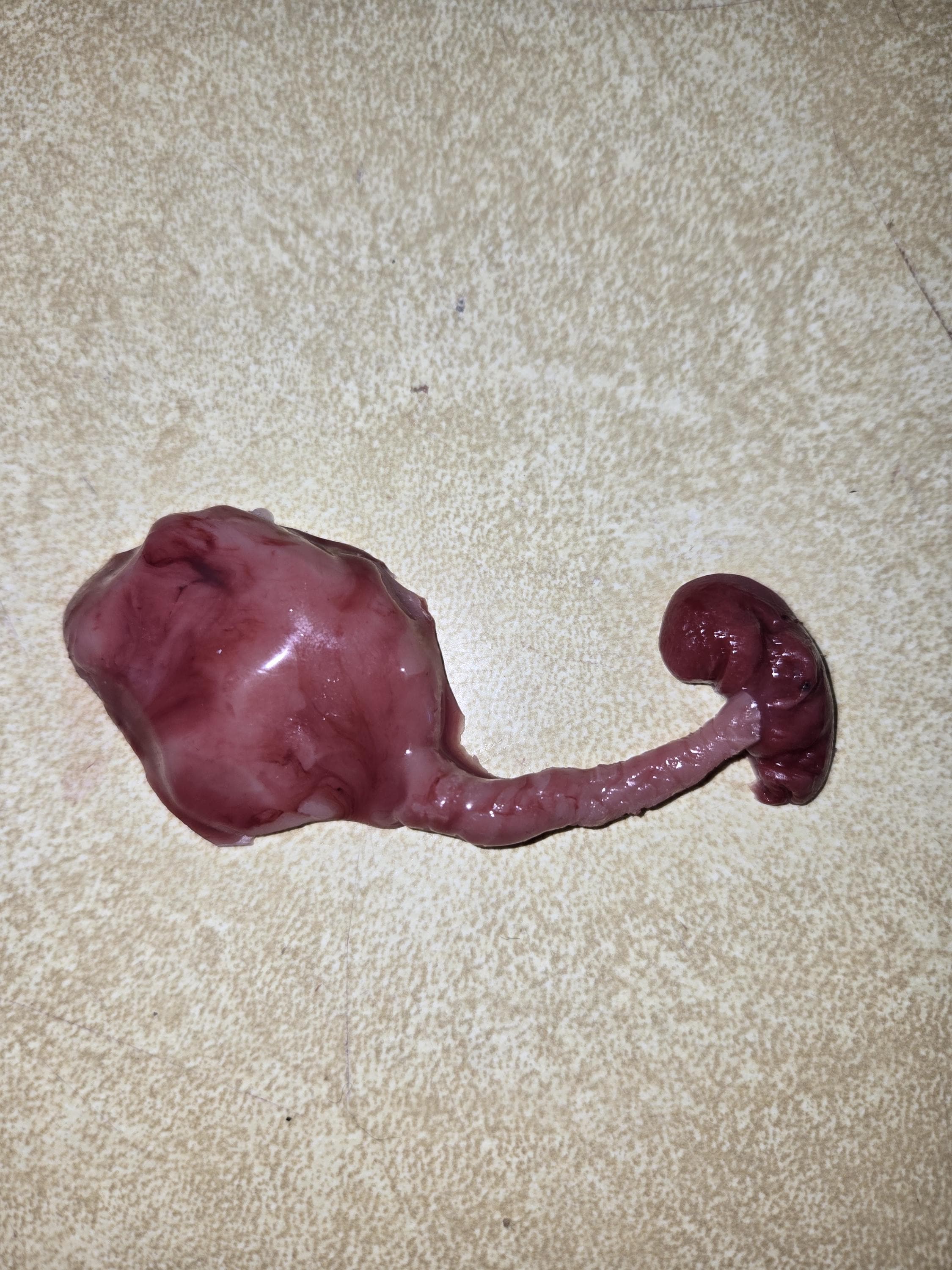 fetus silicone baby memorial with umbilical cord attached