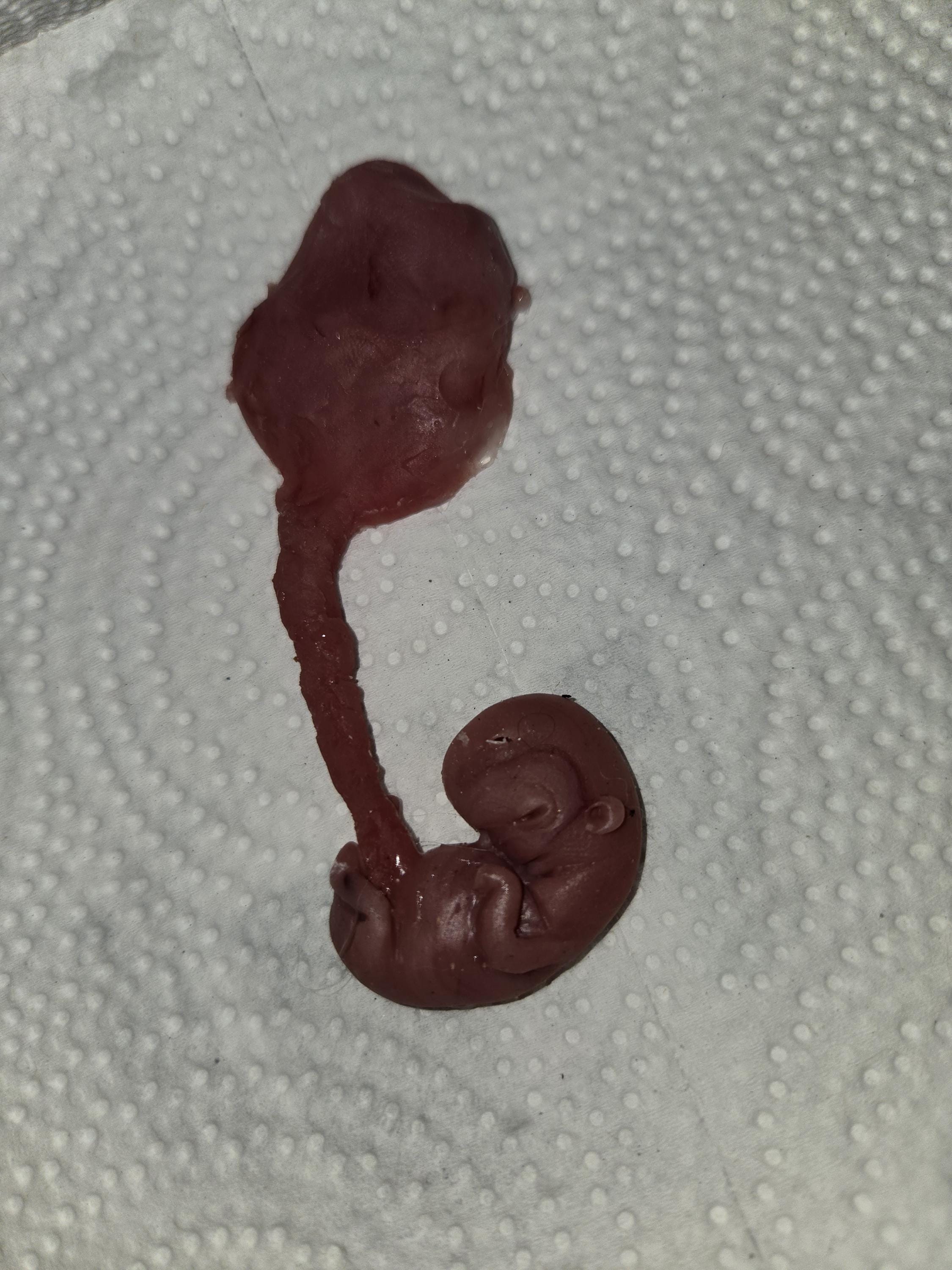 Silicone fetus with placenta and umbilical cord