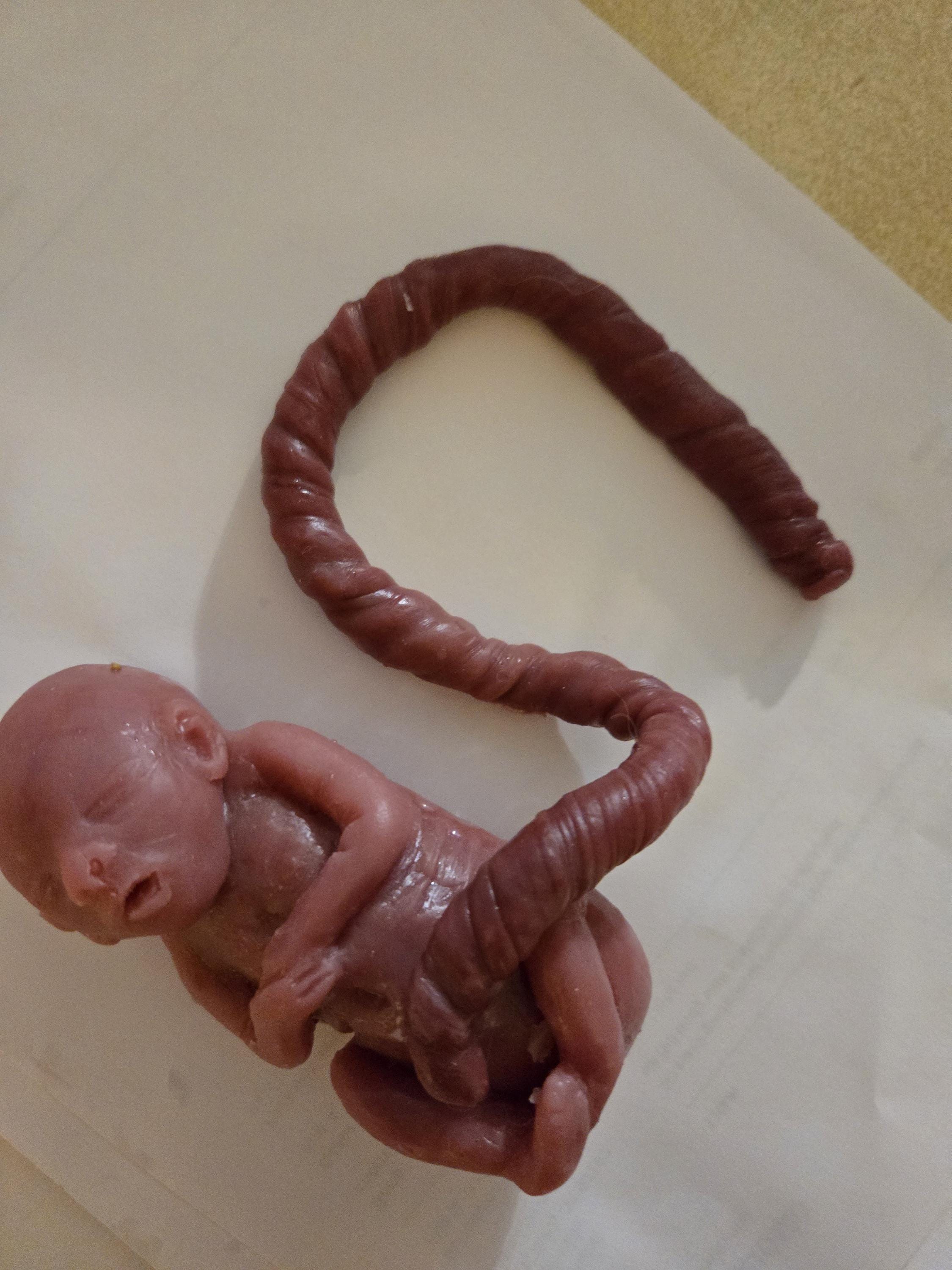 20 week gestational memorial fetus silicone baby curled up full body with umbilical cord attached